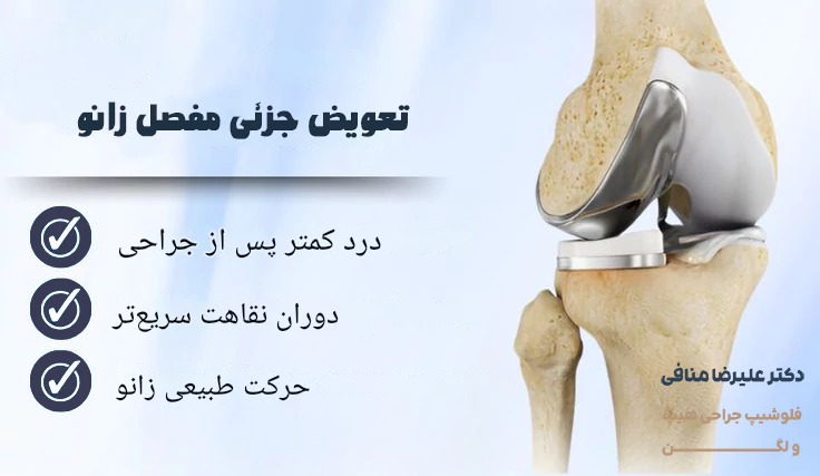 تعویض جزئی مفصل زانو