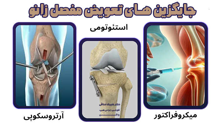 جایگزین های عمل تعویض مفصل زانو