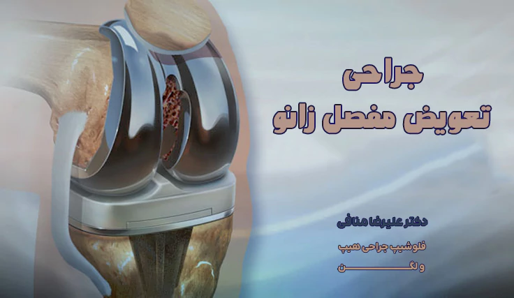 جراحی تعویض مفصل زانو