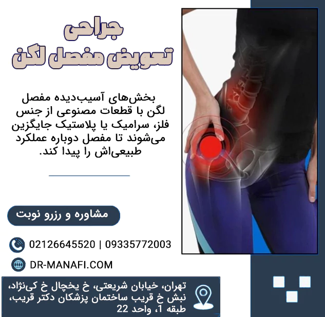 جراحی تعویض مفصل لگن