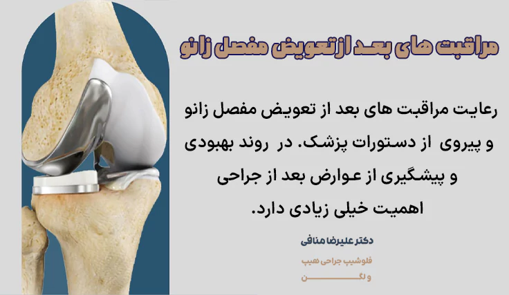 مراقبت های بعد از تعویض مفصل زانو