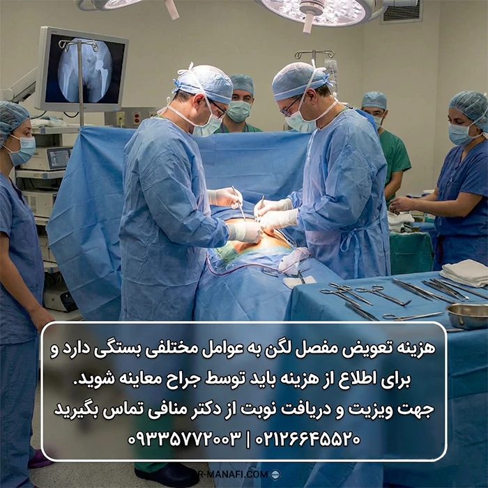 هزینه عمل تعویض مفصل لگن