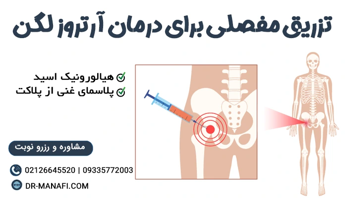 تزریق مفصلی برای درمان آرتروز لگن