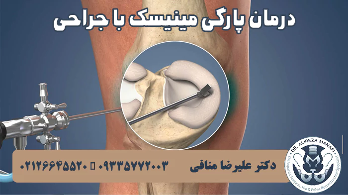 درمان پارگی مینیسک با جراحی