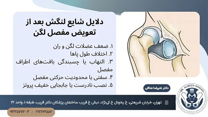 علت لنگیدن بعد تعویض مفصل لگن