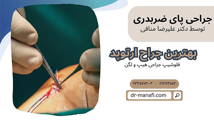 عمل جراحی پای ضربدری