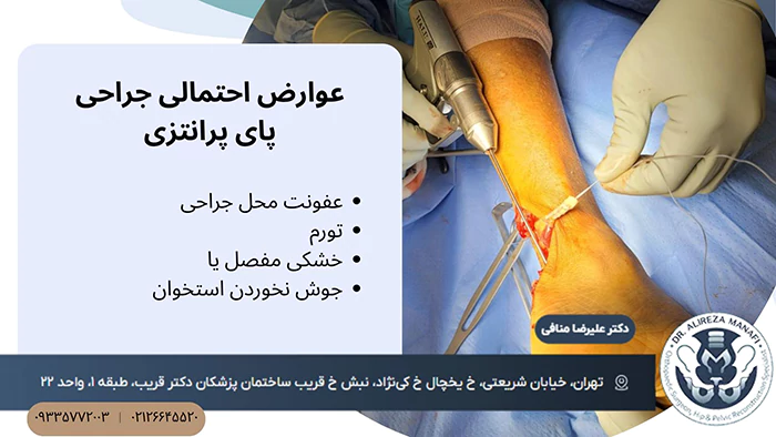 عوارض جراحی پای پرانتزی