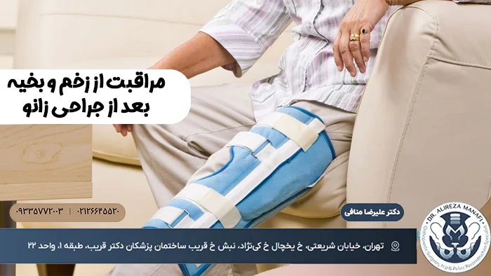 مراقبت از زخم و بخیه بعد از جراحی زانو