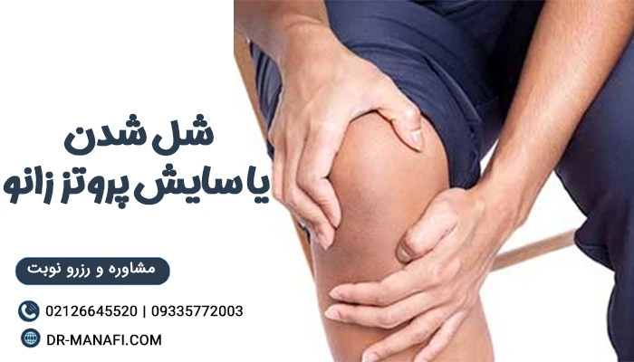 سایش پروتز زانو