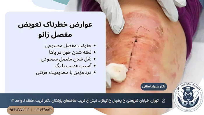 عوارض خطرناک تعویض مفصل زانو