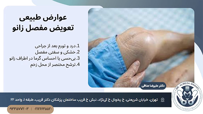 عوارض طبیعی تعویض مفصل زانو