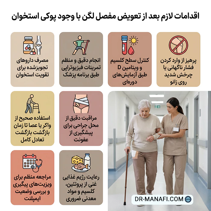 اقدامات لازم بعد از تعویض مفصل زانو در پوکی استخوان