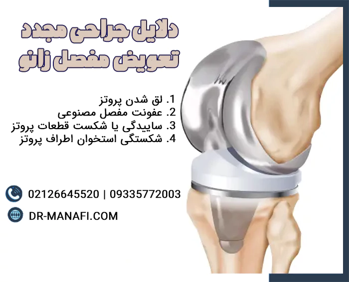 دلایل تعویض مجدد مفصل زانو