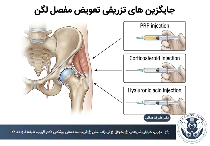 جایگزین های تعغویض مفصل لگن