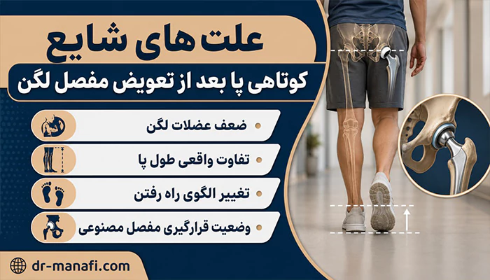 علت کوتاهی پا بعد از تعویض مفصل لگن