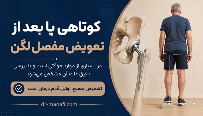 کوتاهی پا بعد از تعویض مفصل لگن