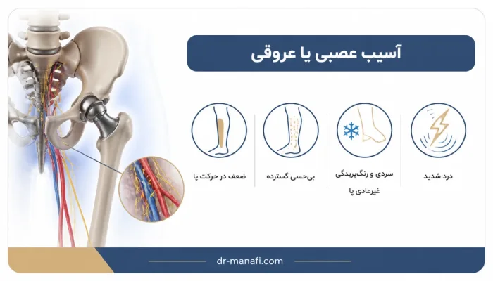 نمای توضیحی درباره آسیب عصبی یا عروقی